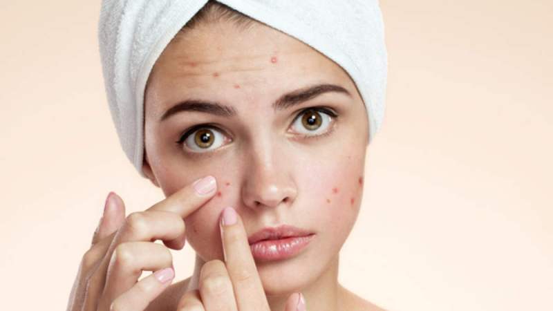 Stay Away From Pimple Outbreak by Having Regular Sleep