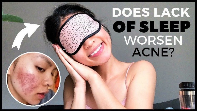 Do Rise of Hormones Due To Lack Of Sleep Cause Pimples?