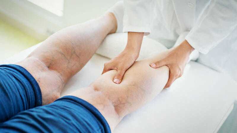 Reliable Treatment Options for Varicose Veins