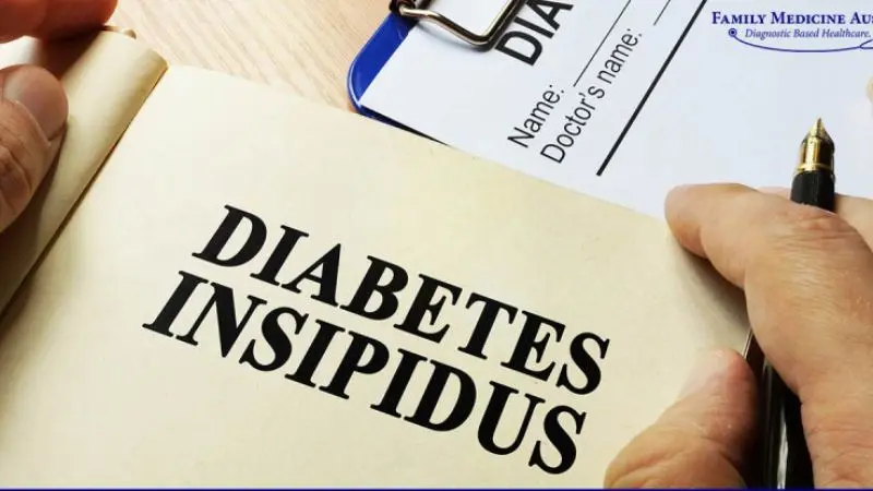 Comprehensive Diagnosis of Diabetes Insipidus